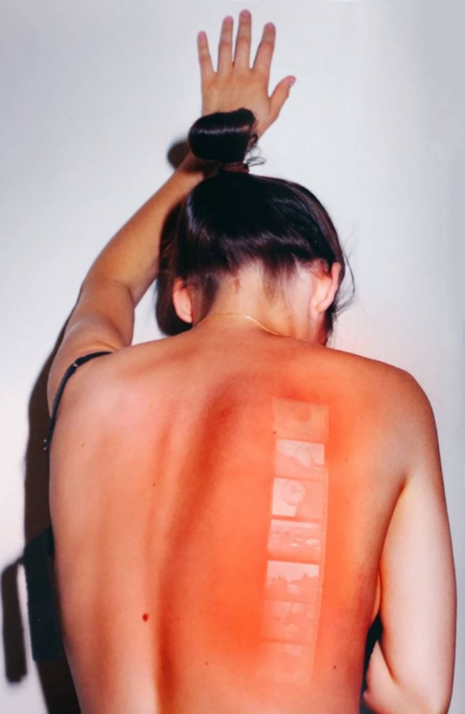sunburnspictrues-1-900x1381